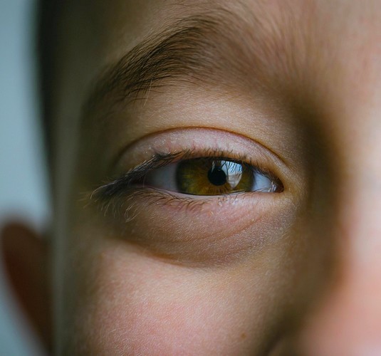 wallen onder de ogen